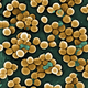MRSA, a bug resistant to many antibiotics. IMAGE: Wikimedia Commons